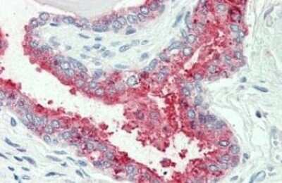 Immunohistochemistry-Paraffin: NKCC1/SLC12A2 Antibody [NBP3-14422]